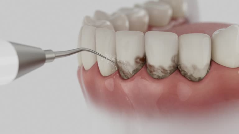 Reliable Dental contractor in Deming, NM by Smile Center Dentistry